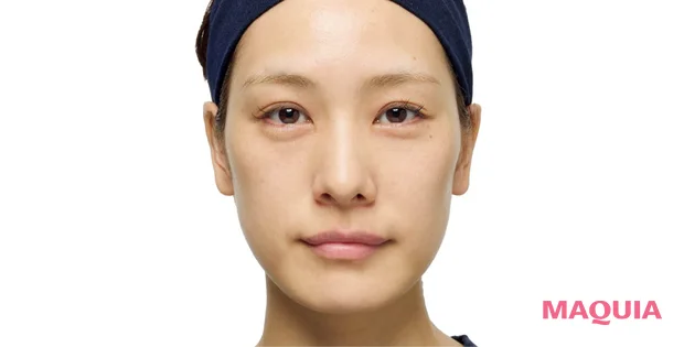 ビタミンC美容液 ダーマレーザー スーパーブラックVC 1ショット 黒ずみ毛穴への効果