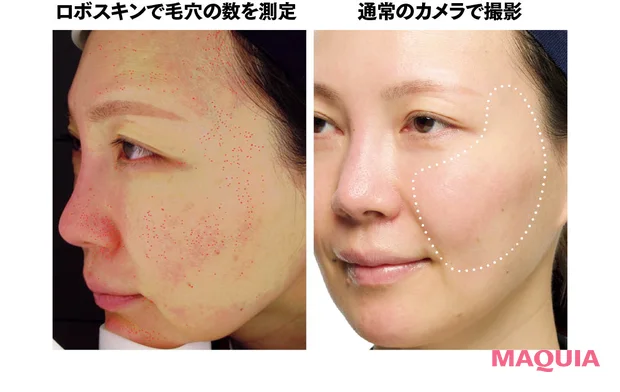 Yunth(ユンス)「Pure AZ Mask」の赤み・毛穴ケア効果を検証 ビフォー