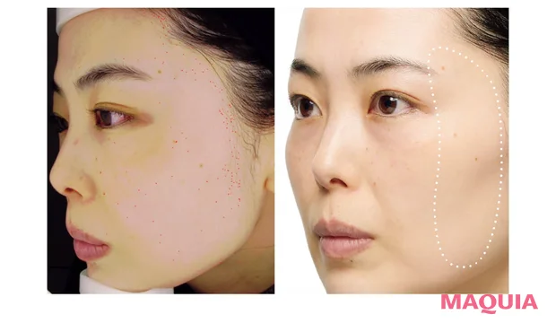 VT COSMETICS レチナール ペプチド セラムの効果検証 アフター