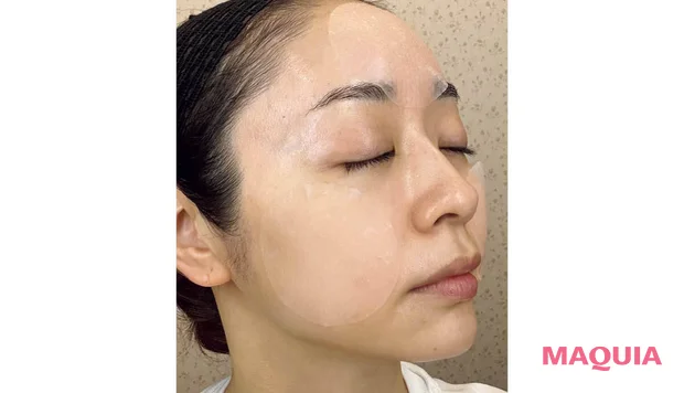 2026年夏 「トナーパッド・部分用マスク」おすすめ Biodance コラーゲンゲルトナーパッド 貼った様子 横顔