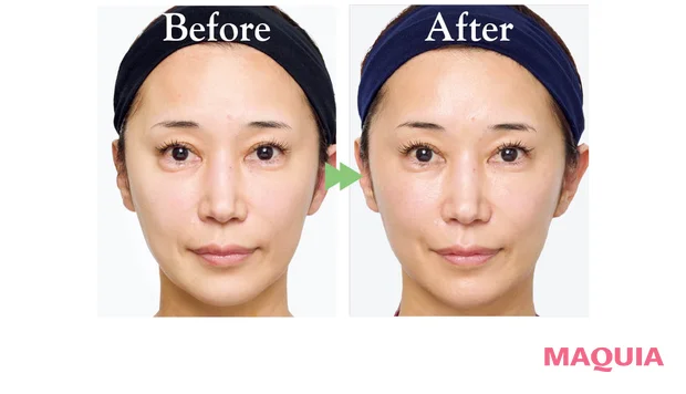 2026年春夏新作 おすすめブライトニングスキンケア SK-II ジェノプティクス アドバンスド スポット エッセンス ビフォーアフター