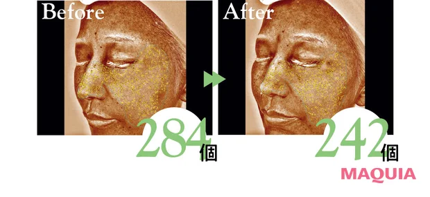 2026年春夏新作 おすすめブライトニングスキンケア SK-II ジェノプティクス アドバンスド スポット エッセンス 表面下シミの個数ビフォーアフター